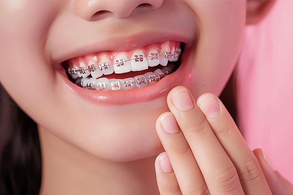 Traditional Braces for teeth straightening are available at Morris Dental Care, Oldham
